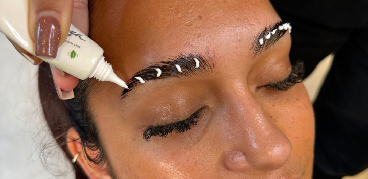 brow lift