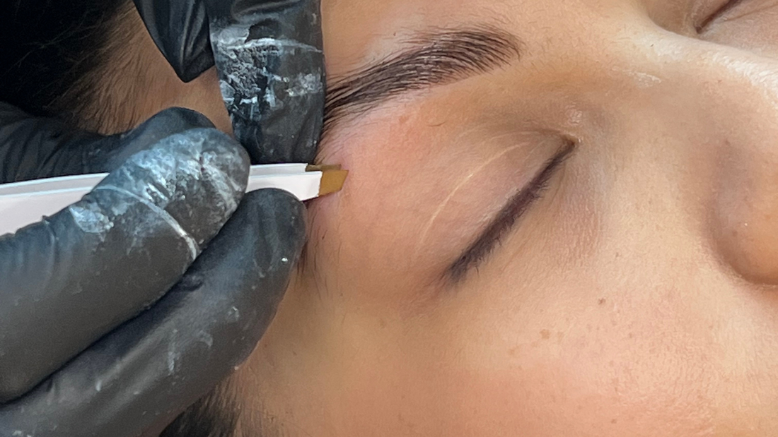 formation brow lift